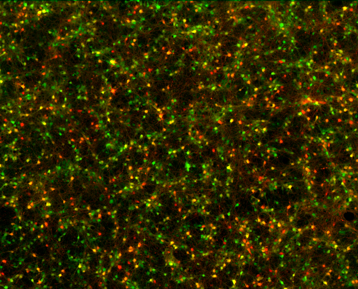 Cultured neurons viewed by fluorescence microscopy